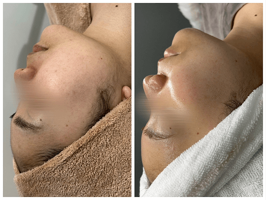 beforeafterの画像