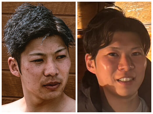 スキンケア施術前後の男性の肌印象を比較した写真